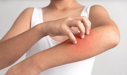 Bite balm for sensitive skin
